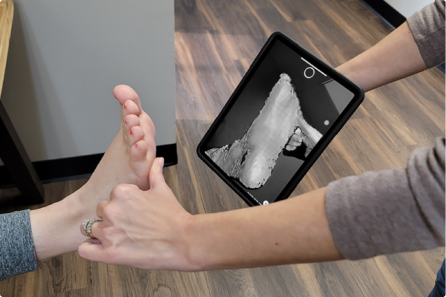 SoleScan 3D scanning technology in use